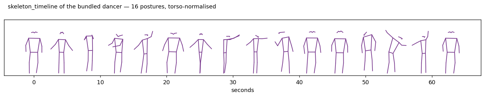 Skeleton timeline
